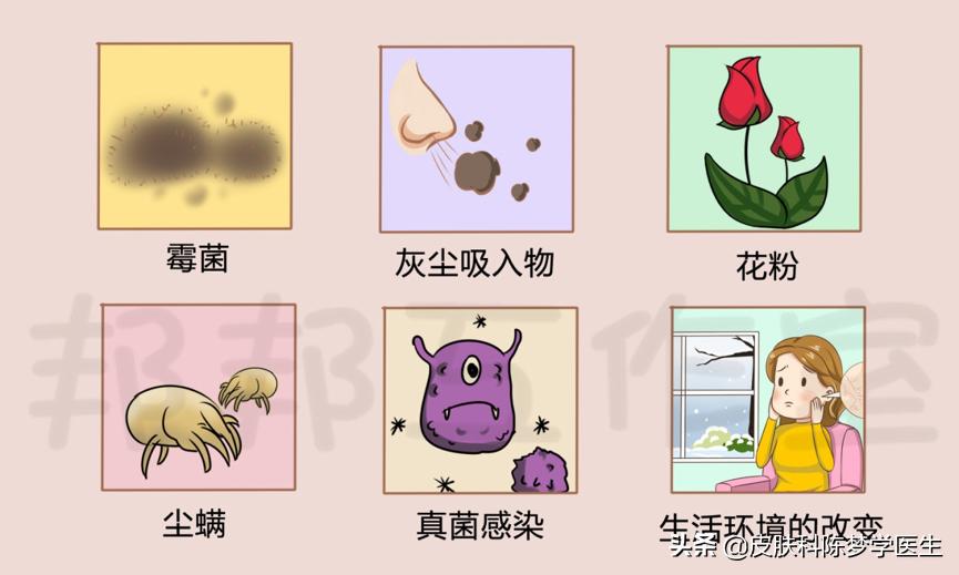 湿疹去药店买什么药擦比较好,药房可买到的没有激素的湿疹药膏