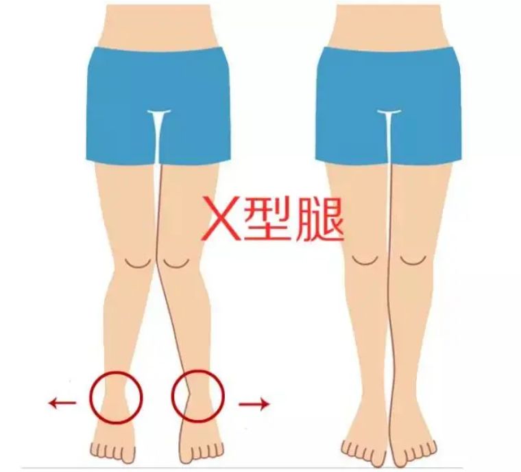 腿型不好怎么穿搭图片,腿型不好怎么穿搭