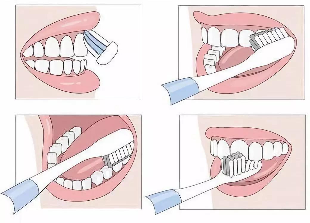 牙黄最有效变白方法,牙黄变白的正确方法学生党