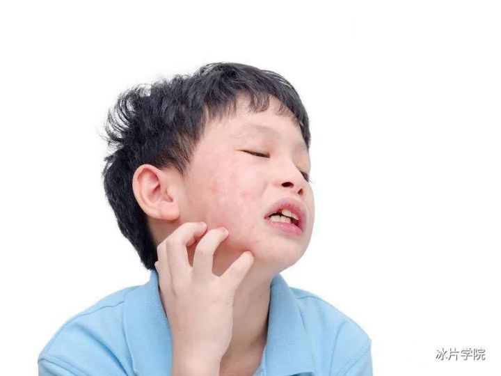 痤疮皮肤毛囊发炎应该怎么办,痤疮毛孔粗大皮肤粗糙