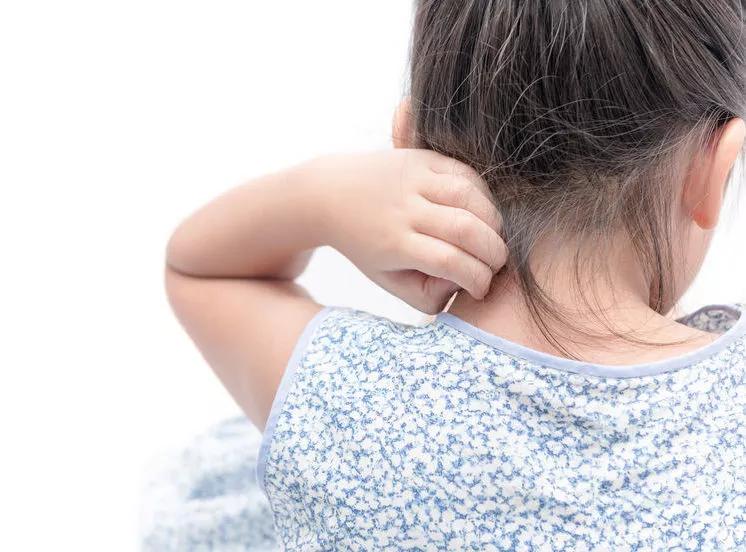 小孩脸冬天出冻疮还有红疙瘩,冬天皮肤湿疹干燥发痒怎么办