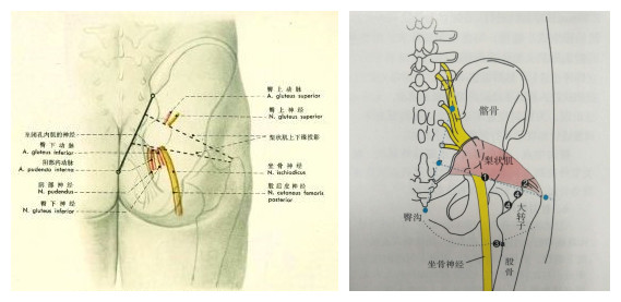 屁股痛、腿麻,有块肌肉受伤了
