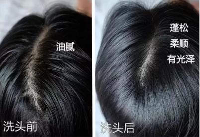 澳洲茶树精油洗发水去头屑,头发一摸全是油