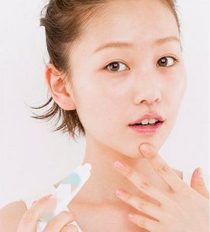 脸上的痘痘和粉刺的区别,女性常见的几种类型痘痘