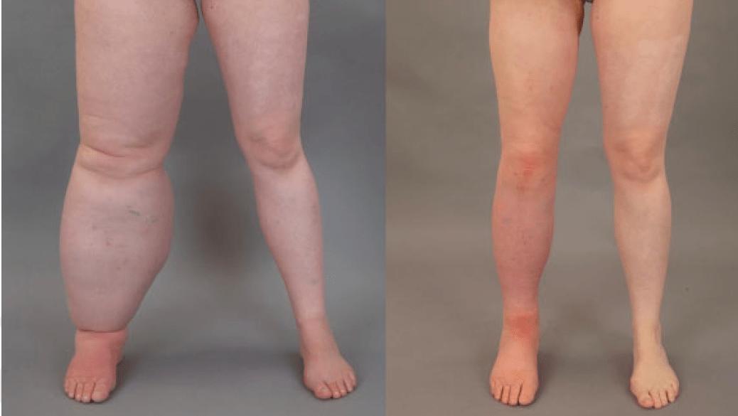 闆ㄥ悗韫氭按涔熸湁鍋ュ悍椋庨櫓,闆ㄥ悗韫氭按涓嶆槸鍎挎垙灏忓績鎯规瘨涓婅韩