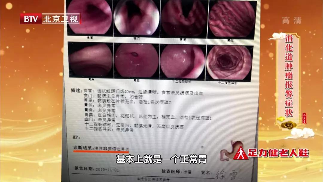 胃胀检查胃镜也没事,胃胀是胃病的一种吗