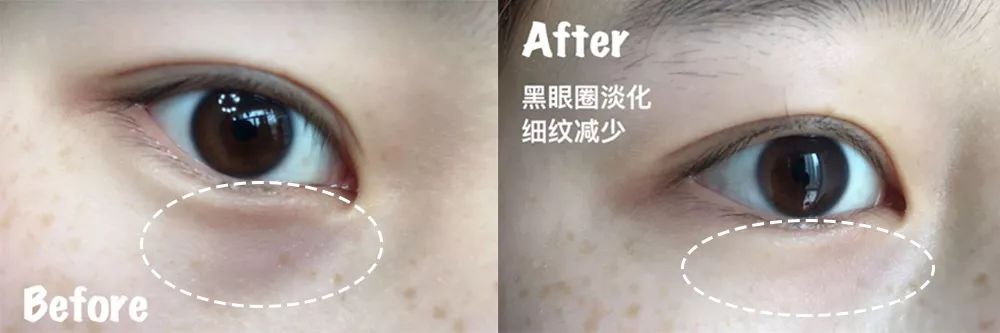 玻尿酸睡眠眼罩,日本去黑眼圈最好的产品