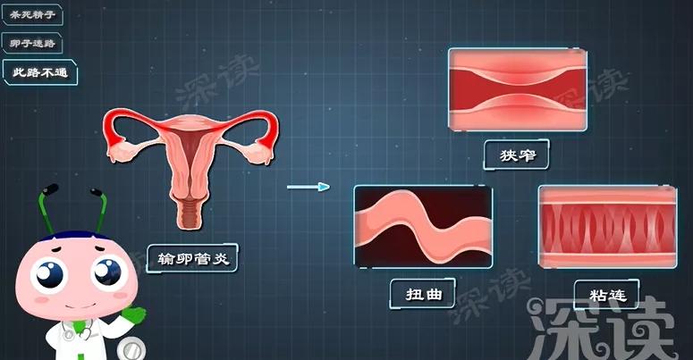 有盆腔炎是不是白带不正常,盆腔炎为什么会白带异常
