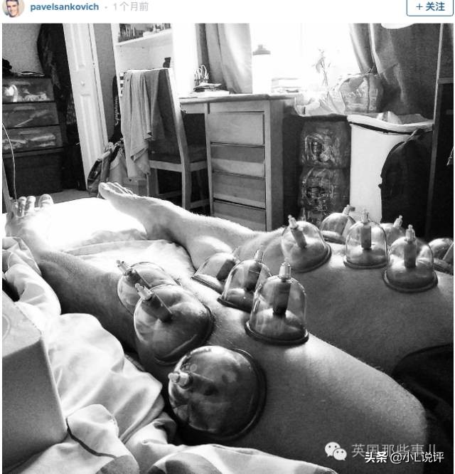 来自东方的神秘力量，让老外痴迷的拔火罐和蚊帐