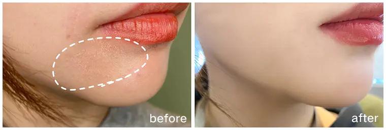 绵羊油适合的肤质,倾慕小铺澳洲绵羊油水润滋养