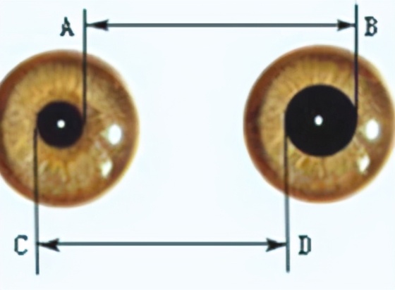 宝宝摔到头怎么应对,宝宝摔到头怎么处理最好