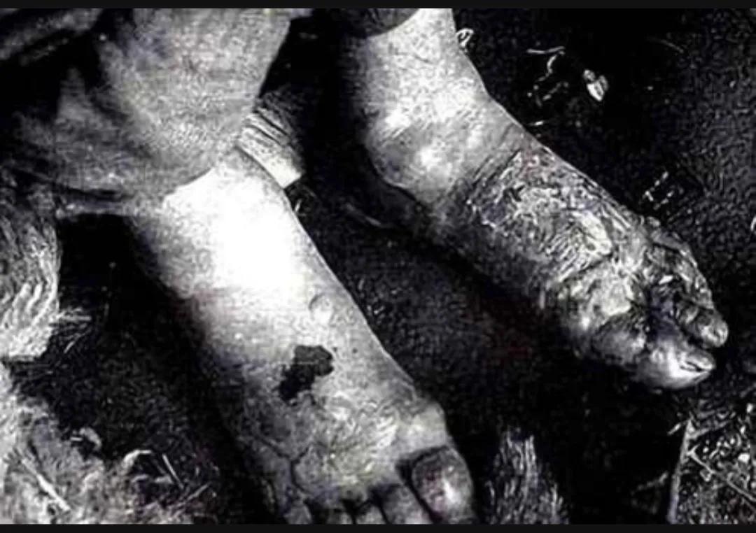 日军731部队冻伤实验是为了什么,日军731实验照片