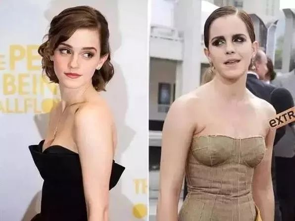 十分钟告别含胸驼背,5个动作改善含胸驼背