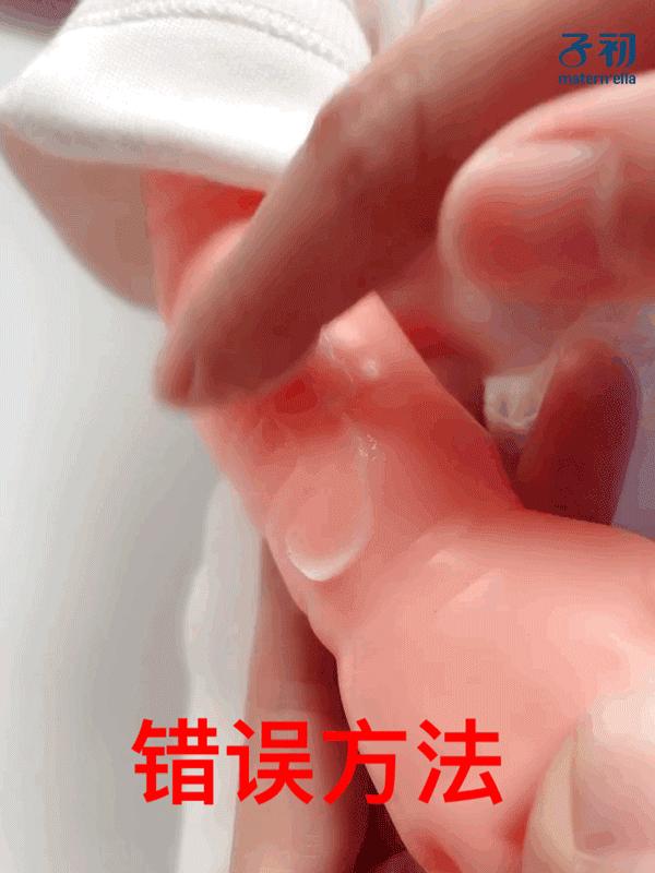 被油烫伤怎么紧急处理,宝宝烫伤怎么简单护理