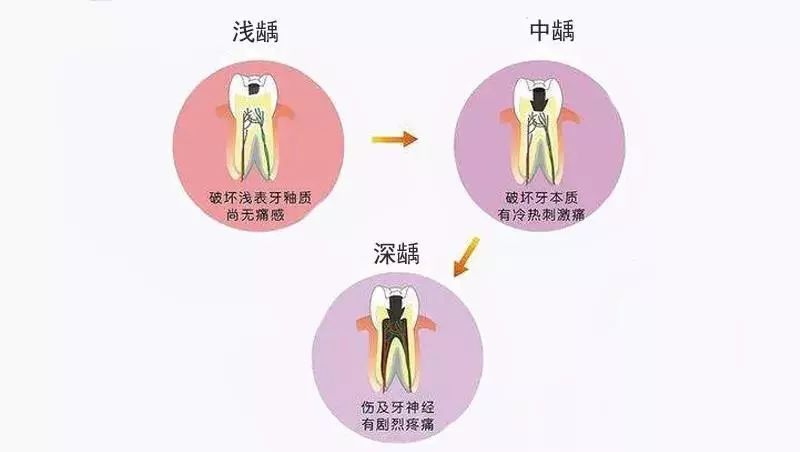 牙髓炎自愈的真实经历,牙髓炎自愈的真实经历是什么