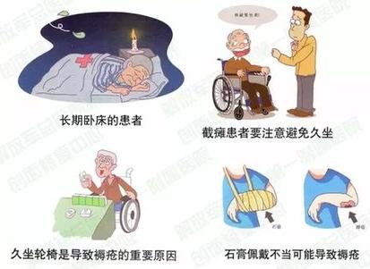 压疮和褥疮是一回事吗,压疮褥疮是一回事吗