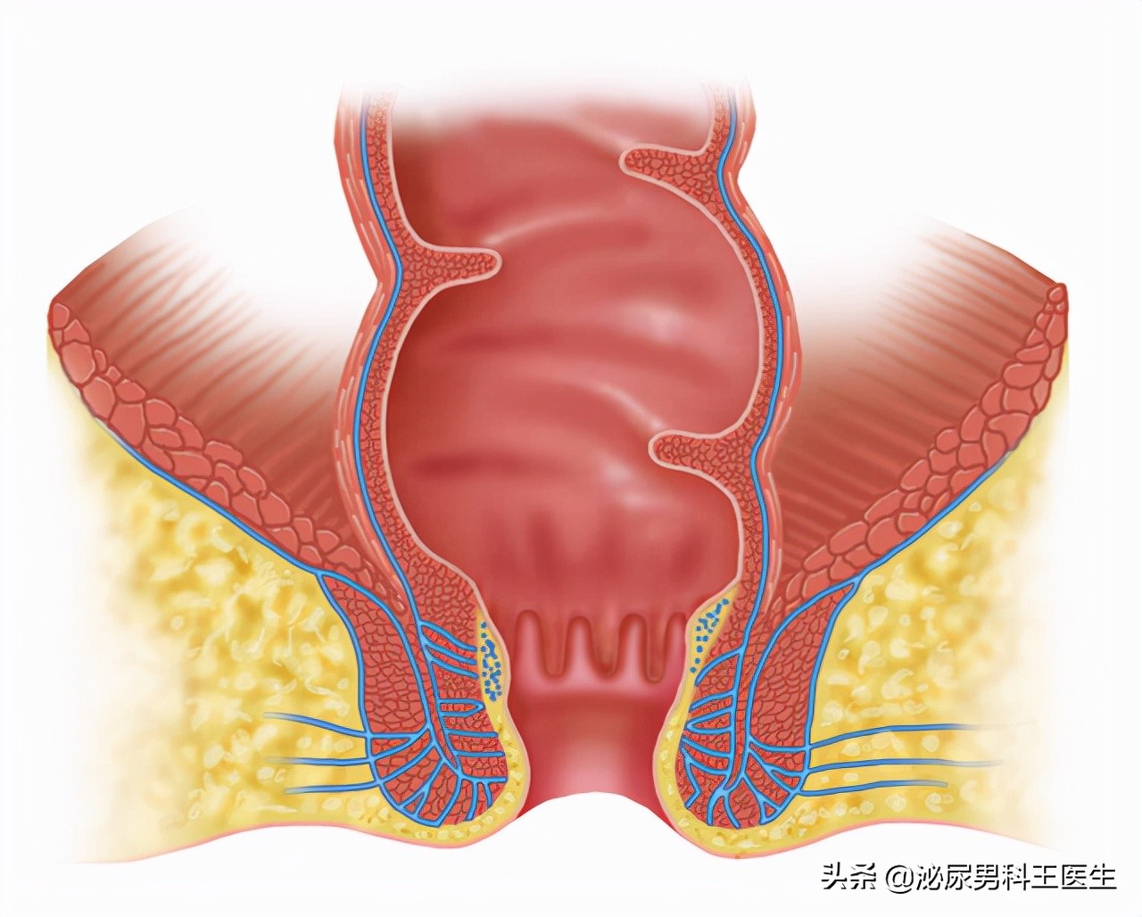 肛瘘患者:“不想治了,我真的太痛了!”肛瘘手术到底有多痛?