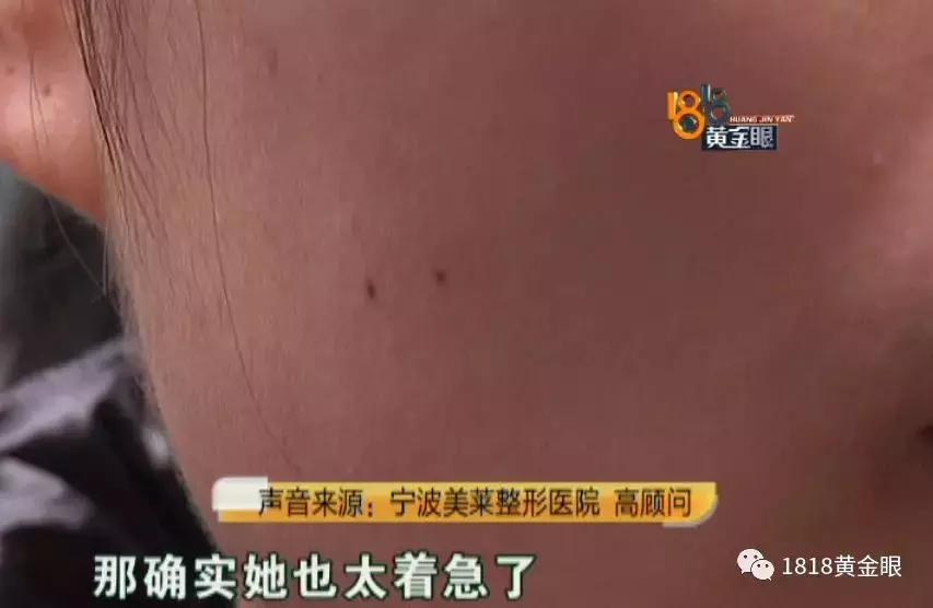 打完瘦脸针成了蛙脸怎么办,打完瘦脸针出现蛙腮会消失吗