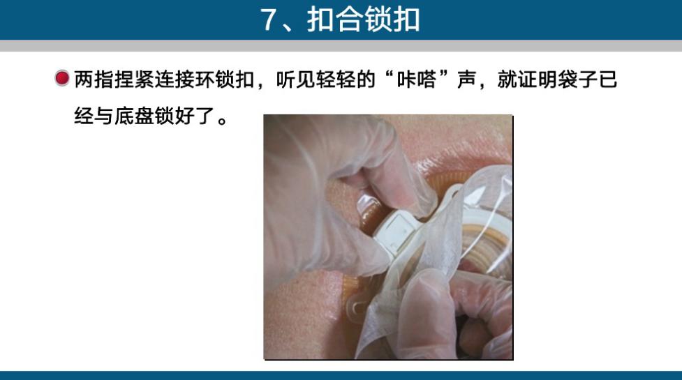 造口手术后多久复查一次,造口复查检查什么