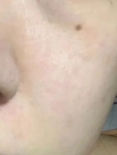 用大牌化妆品真的不会老吗,用大牌护肤品皮肤还是不好