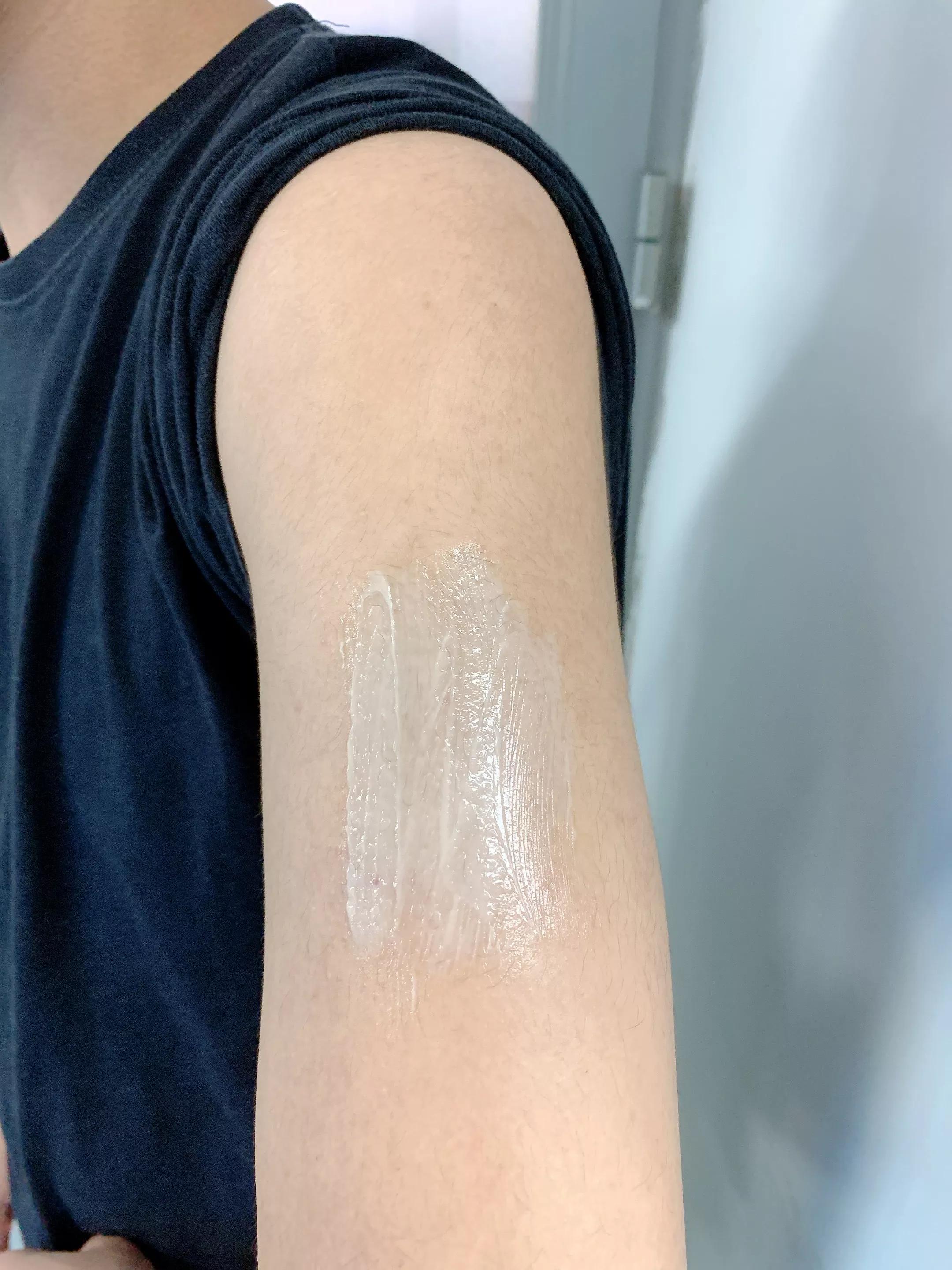 男朋友手臂长小疙瘩是什么原因,男朋友手臂上很多小痘痘是什么