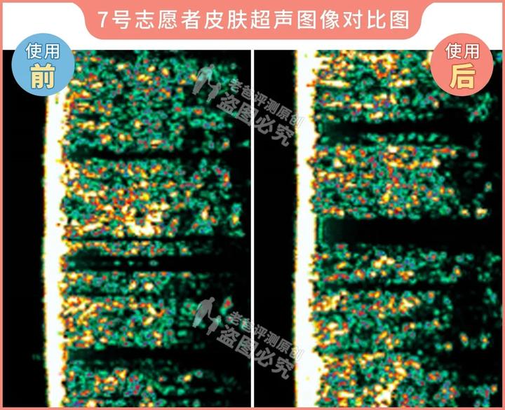 测评家用美容仪真的有用吗,网红推荐的美容仪有用吗