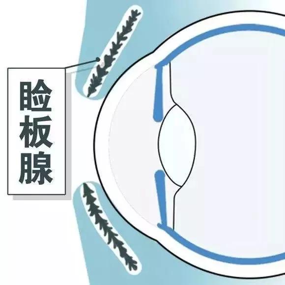 听医生的话丨眼睛分泌物多，还能拉丝？小心眼病在作祟