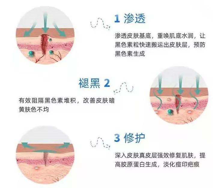 去皮肤科医院看痘痘,北京看痘痘好的皮肤科医院