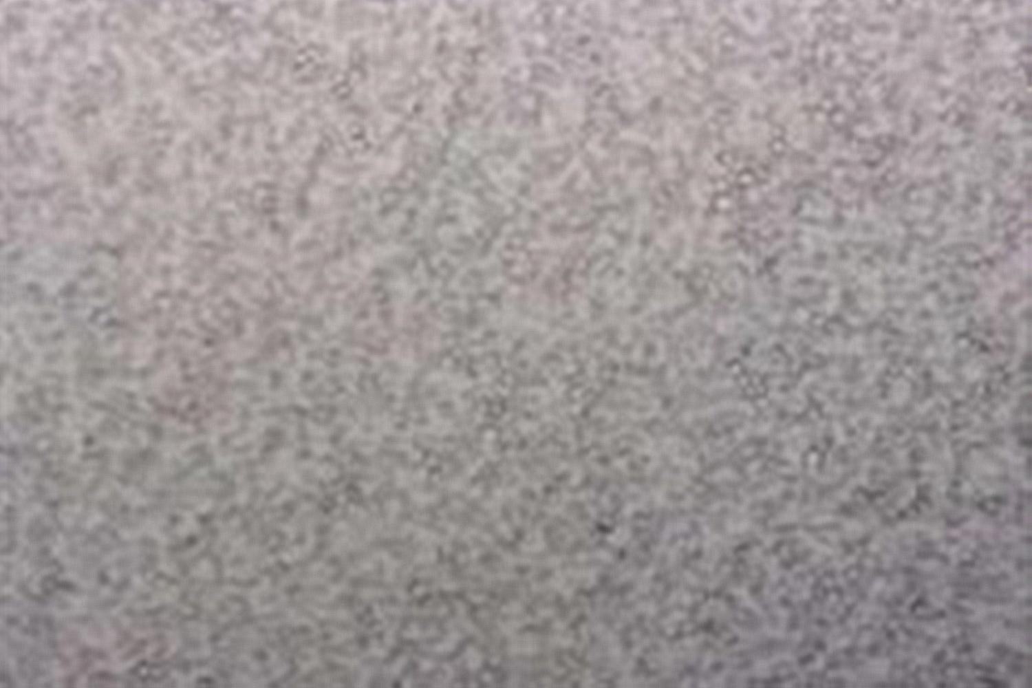 母乳在显微镜下的样子,解冻母乳在显微镜下放大1000倍