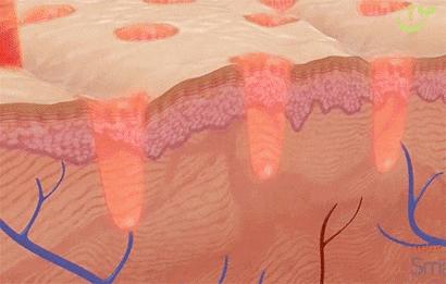 脸色发黄毛孔粗大出油严重怎么办,脸部爱出油长痘毛孔粗大怎么调理