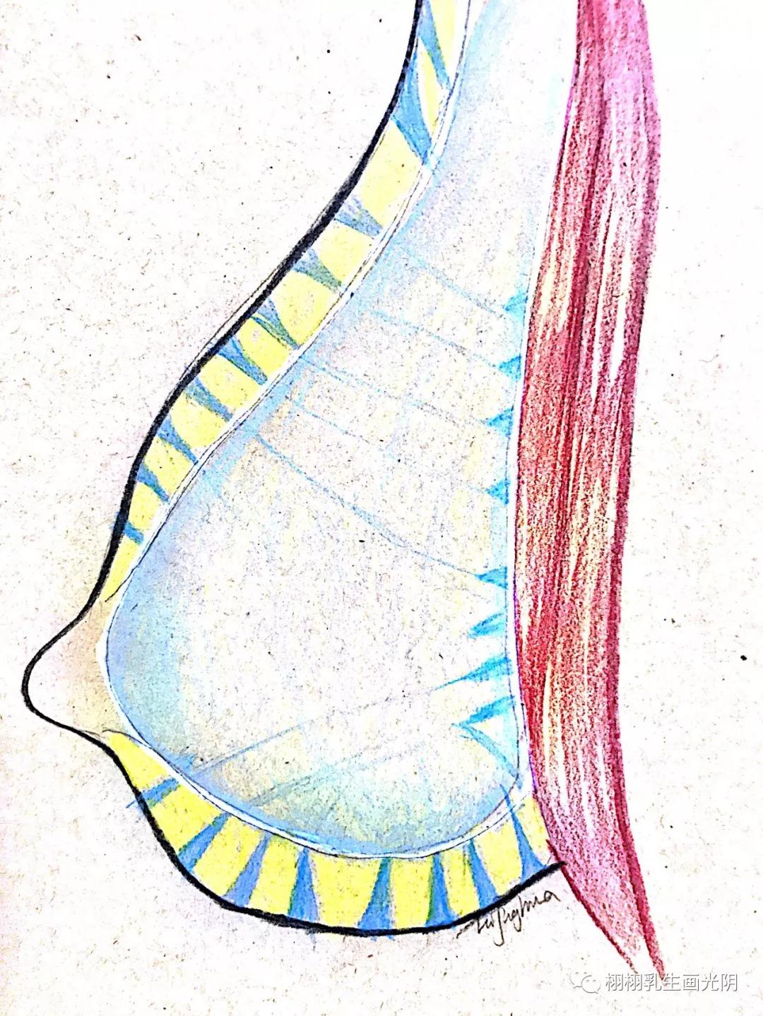 预防乳房下垂健胸操,怎样预防产后乳房下垂