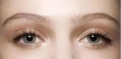 两眼间距宽割双眼皮,双眼皮割宽了还可以做修复吗