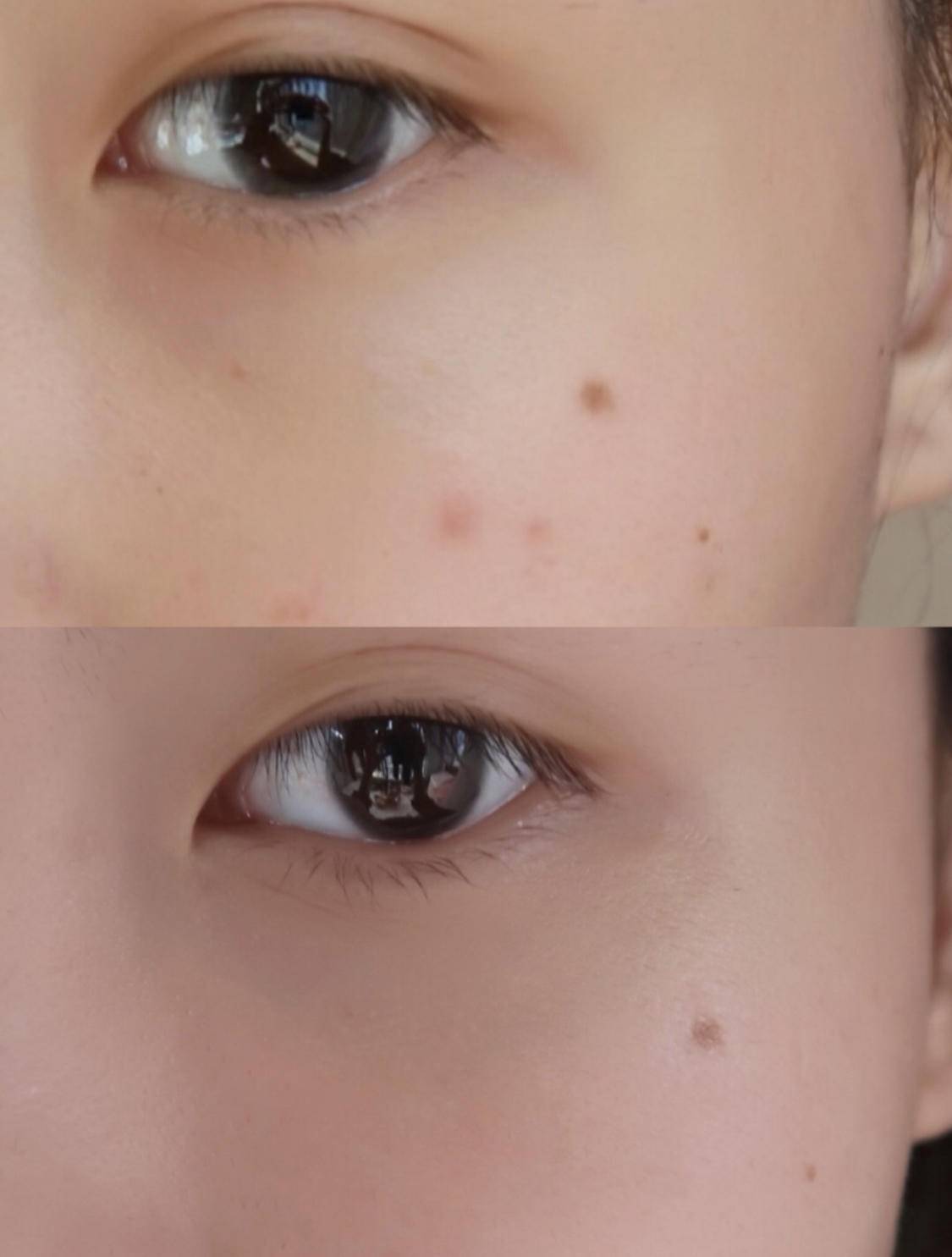 保湿眼霜推荐10款,18岁天生黑眼圈眼袋眼霜推荐平价