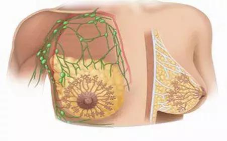 经期前乳房胀痛是乳腺增生吗,乳腺增生月经前10多天乳房胀痛