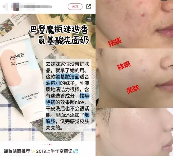 专治螨虫的洗面奶,螨虫专用洁面乳