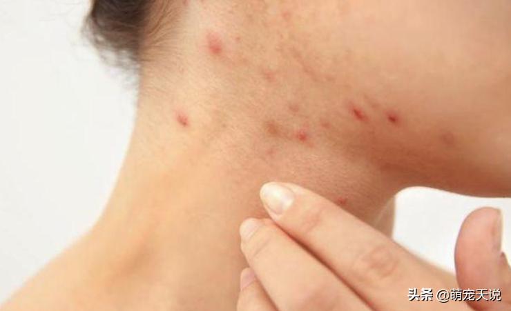 狗狗同床睡的危害,狗狗跟人一起睡对人有什么坏处