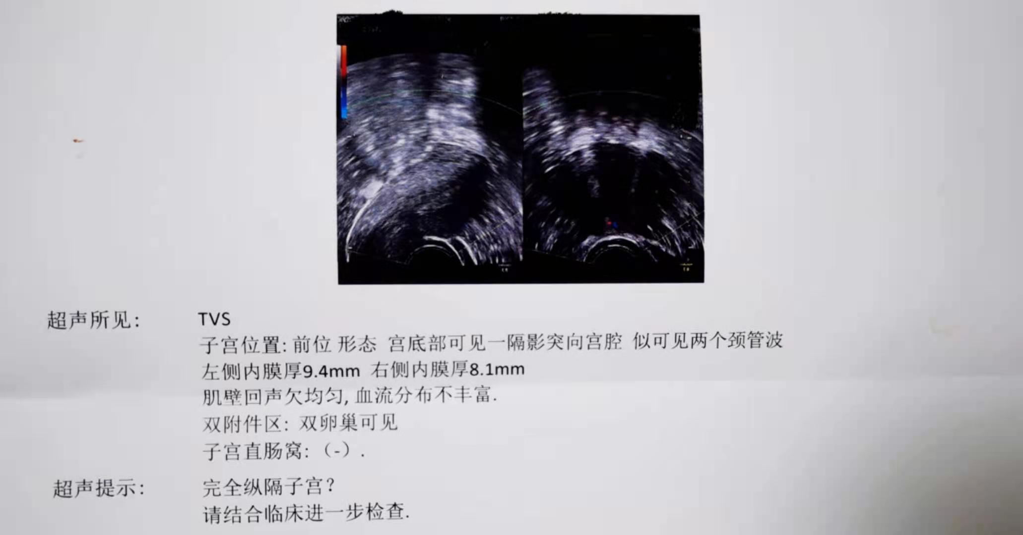 被儿子一脚踢到肚子,子宫被人踢了一脚