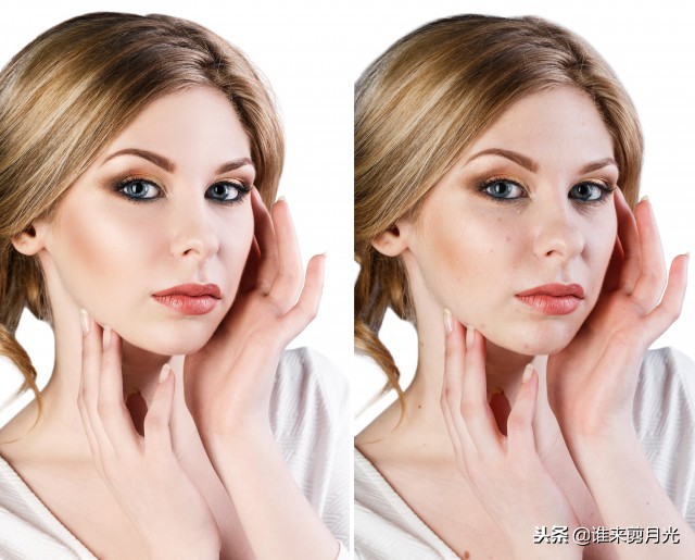 脸的两侧痘痘怎么消除,脸的两侧长痘痘用什么药膏