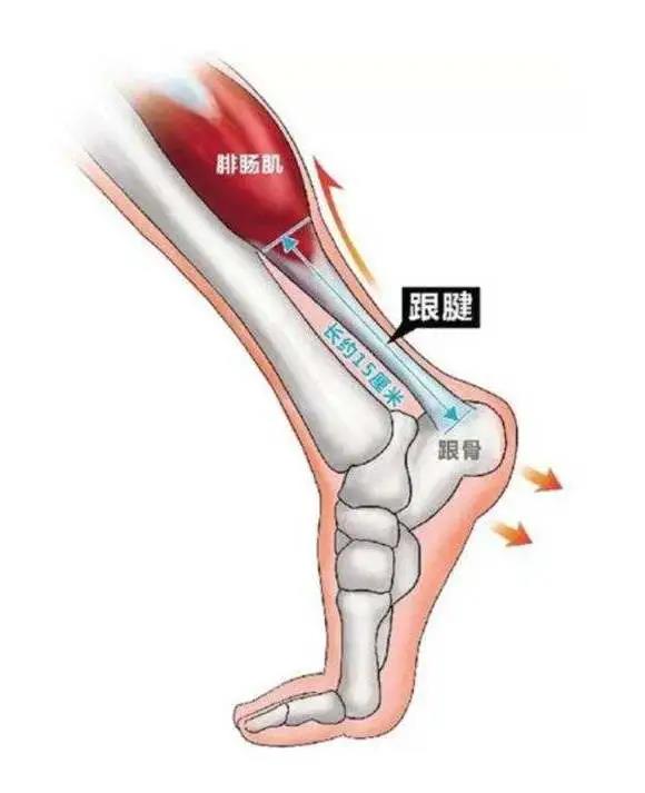 跟腱断裂康复的几个阶段,跟腱断裂手术三周跟腱恢复情况