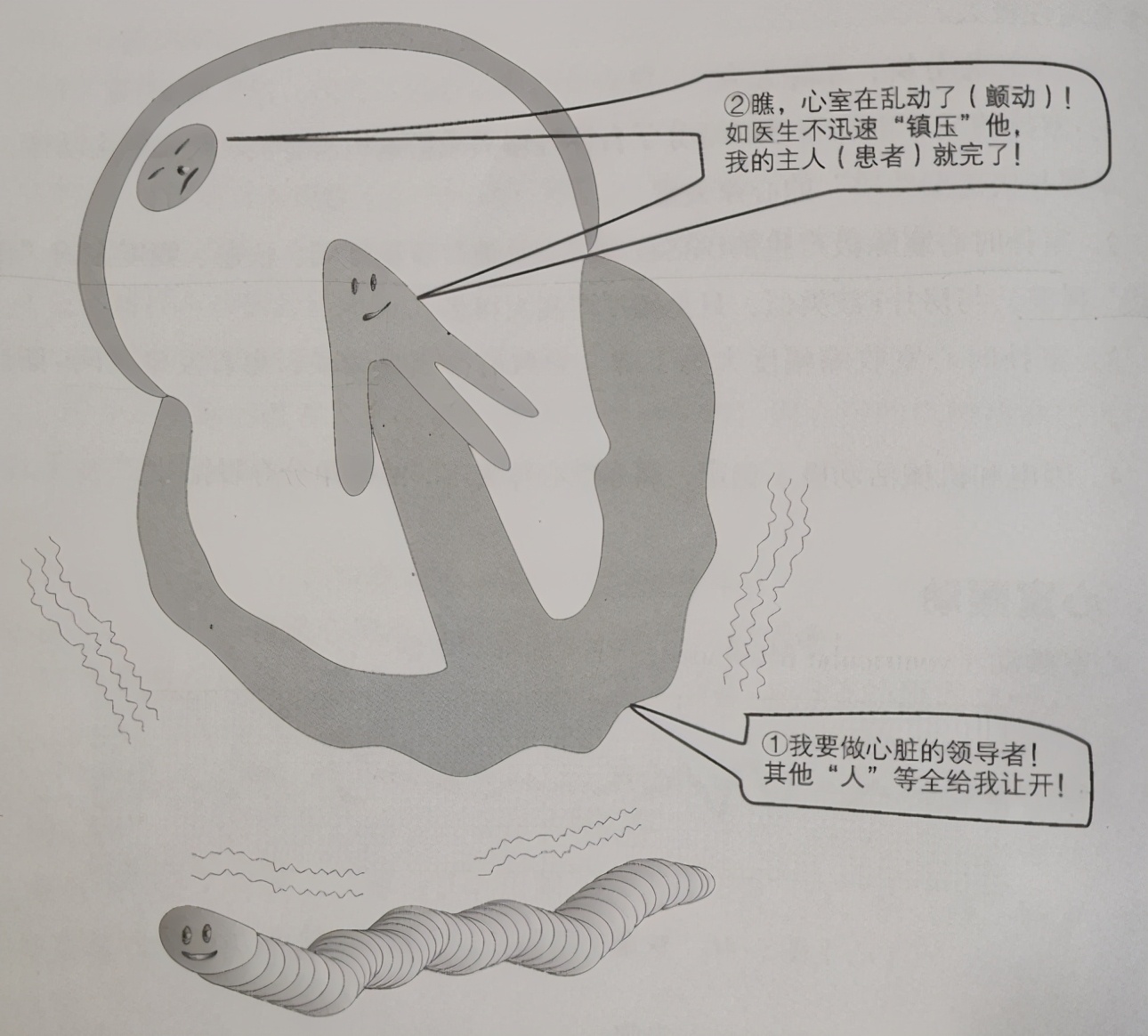 埃里克森晕倒做了什么样的手术,埃里克森植入的是全皮下icd吗