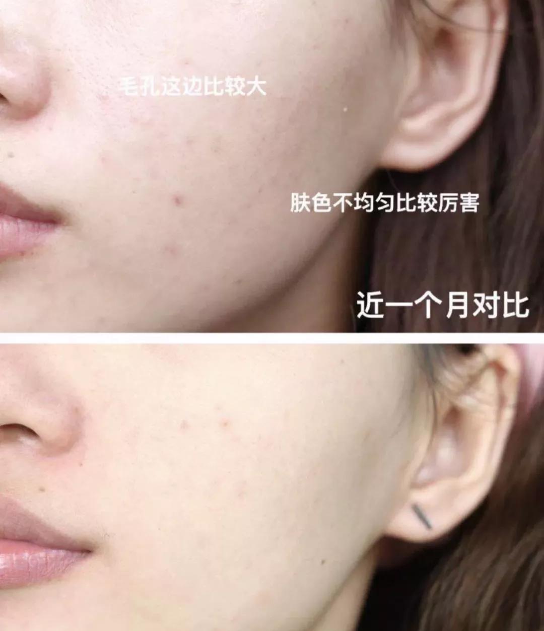 效果最好的熬夜面膜,去闭口熬夜最适合用的面膜