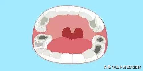 牙不好会引发什么疾病,牙不好容易得什么病