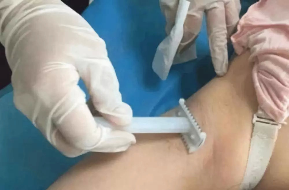 生孩子为什么要刮毛？99%以上的妈妈不知道