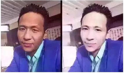 脖子被太阳晒黑了怎么才能变白,被太阳晒黑怎样变白女生