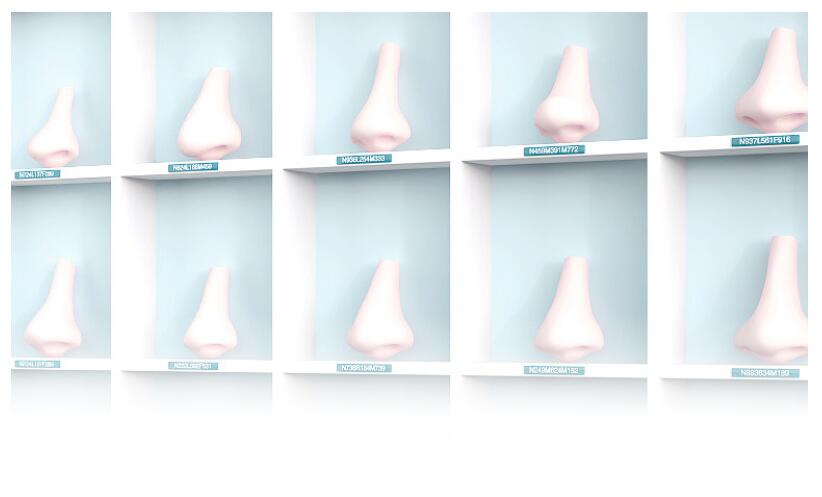 鼻整形五十年后,鼻整形修复三次