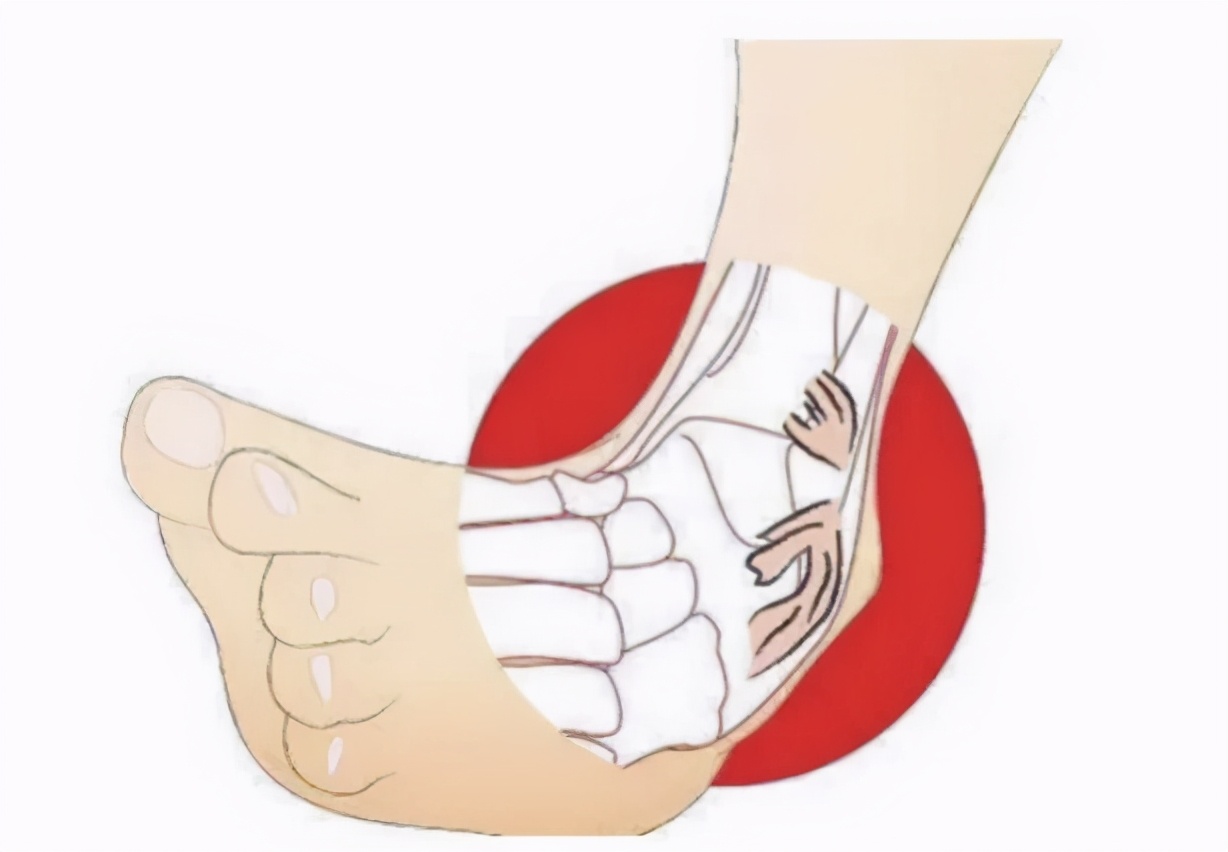 走路习惯性崴脚,走路经常扭到腿是怎么回事