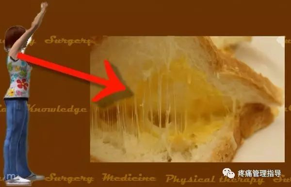 肩周炎的原因与锻炼方法
