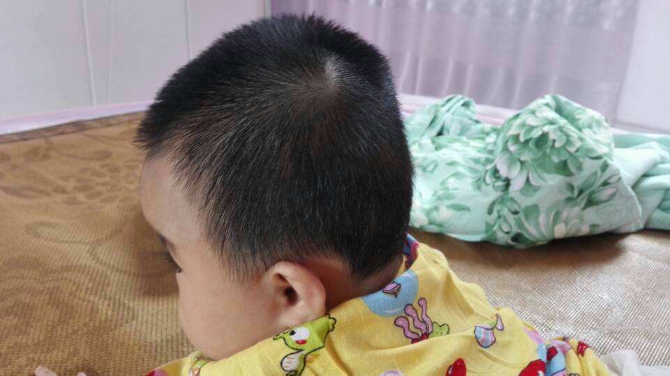 宝宝后脑勺扁的怎么矫正,7个月宝宝后脑勺平怎么补救