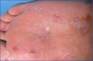 高温高湿季节怎么防止病害,高温高湿天怎么缓解