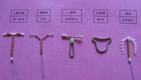 避孕环、节育环、宫内节育器,到底是个啥?